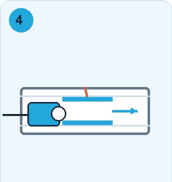 Schematische Darstellung: Packer entfernen und kontrollieren